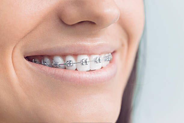 Why Choose Us for Your Dental Needs in Wood River, NE